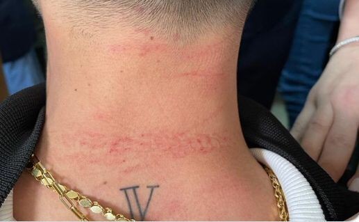 Cerrahpaşa Tıp Fakültesi’nde doktora saldıran şüpheli gözaltına alındı İstanbul Üniversitesi Cerrahpaşa Tıp Fakültesi Dermatoloji Polikliniğinde görev yapan D.D.A isimli doktor, tedavi esnasında hasta yakını S.D’nin ...