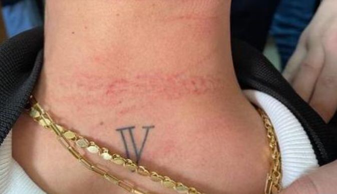 Cerrahpaşa Tıp Fakültesi’nde doktora saldıran şüpheli gözaltına alındı İstanbul Üniversitesi Cerrahpaşa Tıp Fakültesi Dermatoloji Polikliniğinde görev yapan D.D.A isimli doktor, tedavi esnasında hasta yakını S.D’nin ...