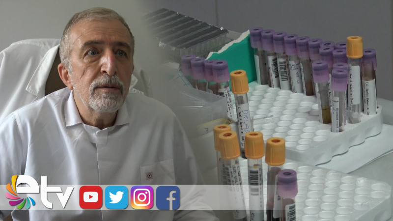 PCR TESTİ ÜCRETİ 170 LİRAYA DÜŞÜRÜLDÜ