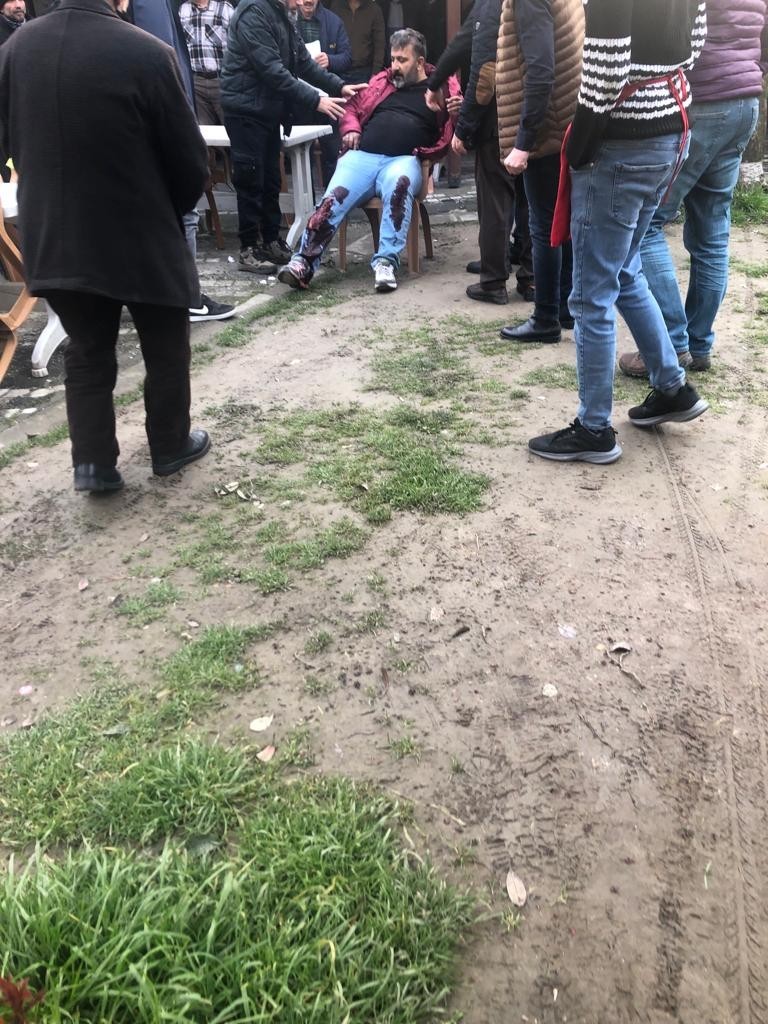 Sakarya’nın Akyazı ilçesinde bir kişi aralarında husumet bulunan şahsı tüfekle ayağından vurduğu anlar ve olaydan dakikalar sonra elini kolunu ...