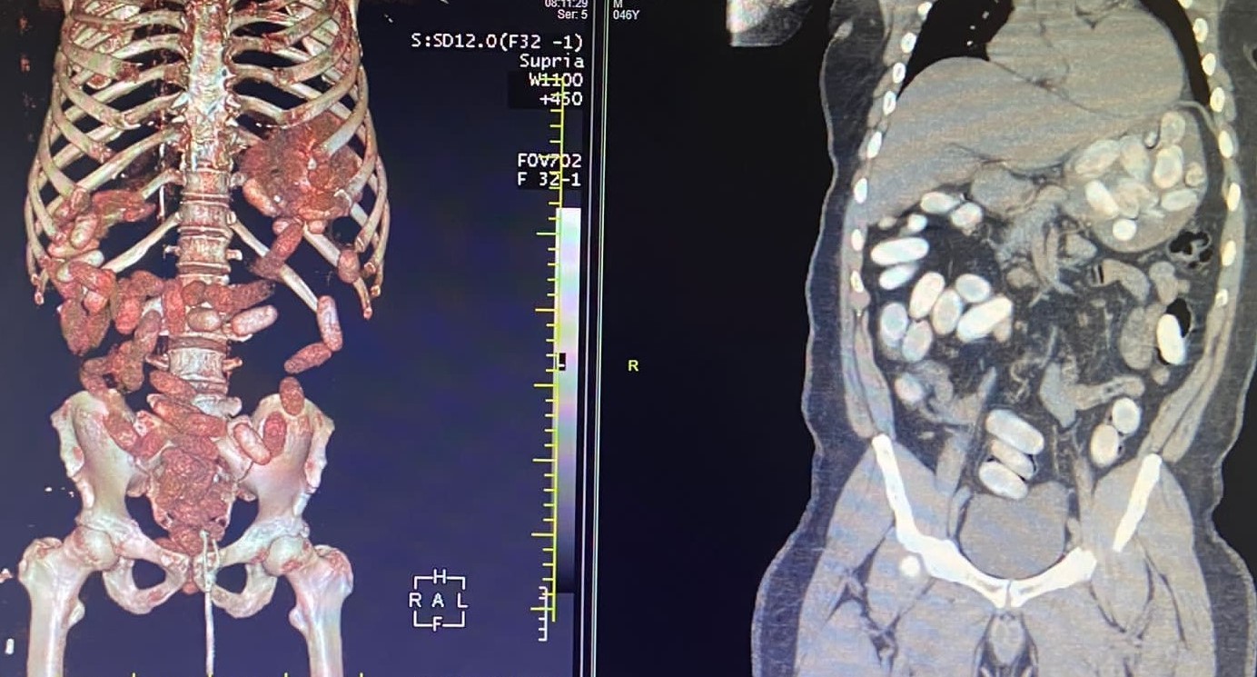 İstanbul Havalimanı’nda gerçekleştirilen iki ayrı uyuşturucu operasyonunda 11 kilo kokain ele geçirildi. Biri organizatör, yedisi kurye olmak ...