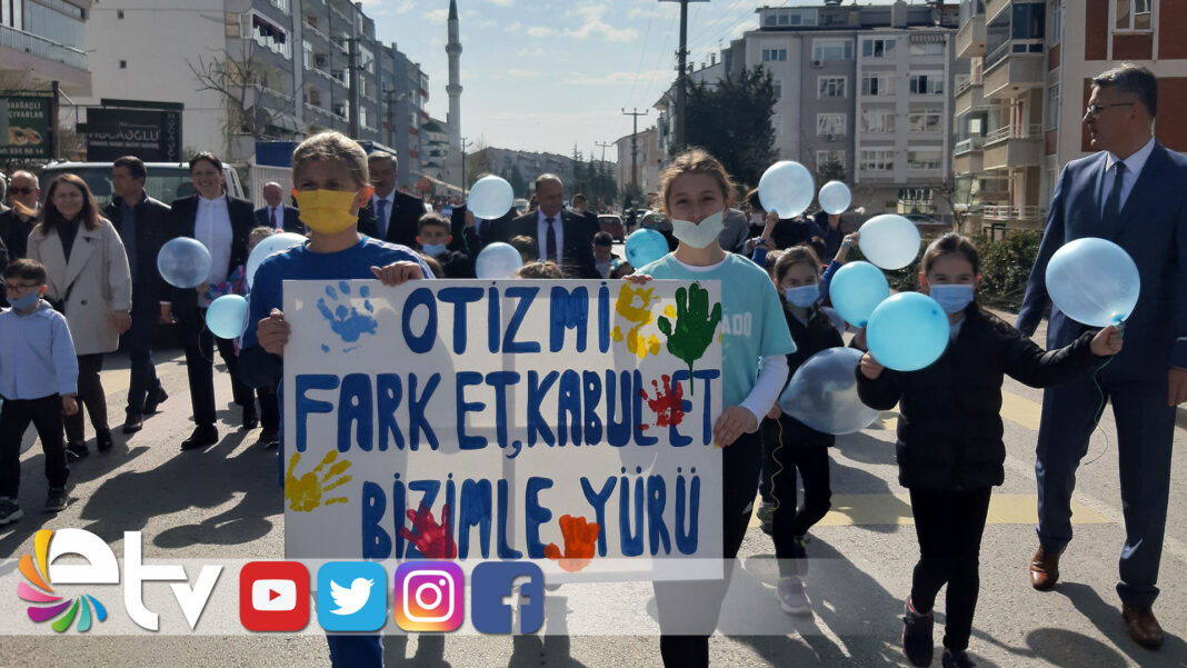 OTIZM