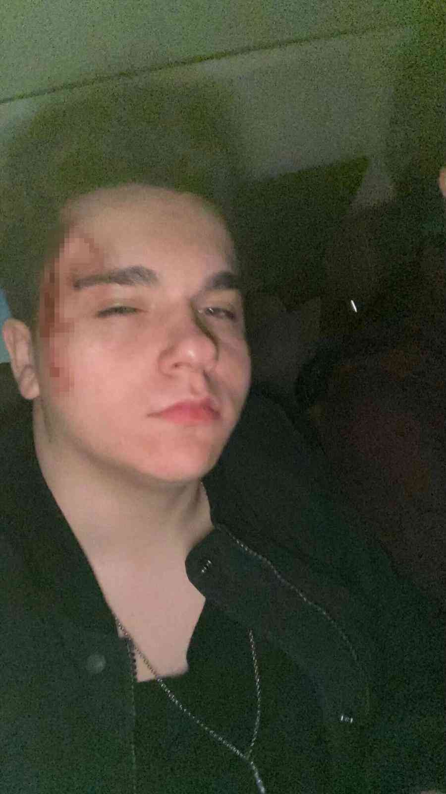 İstanbul’da fenomenlerin partisinde kavga: Masa ve şişeler havada uçuştu Karaköy’de bir gece kulübünde parti veren sosyal medya fenomenleri arasında çıkan tartışma kavgaya dönüştü. Masa, şişe ve yumrukların havada ...