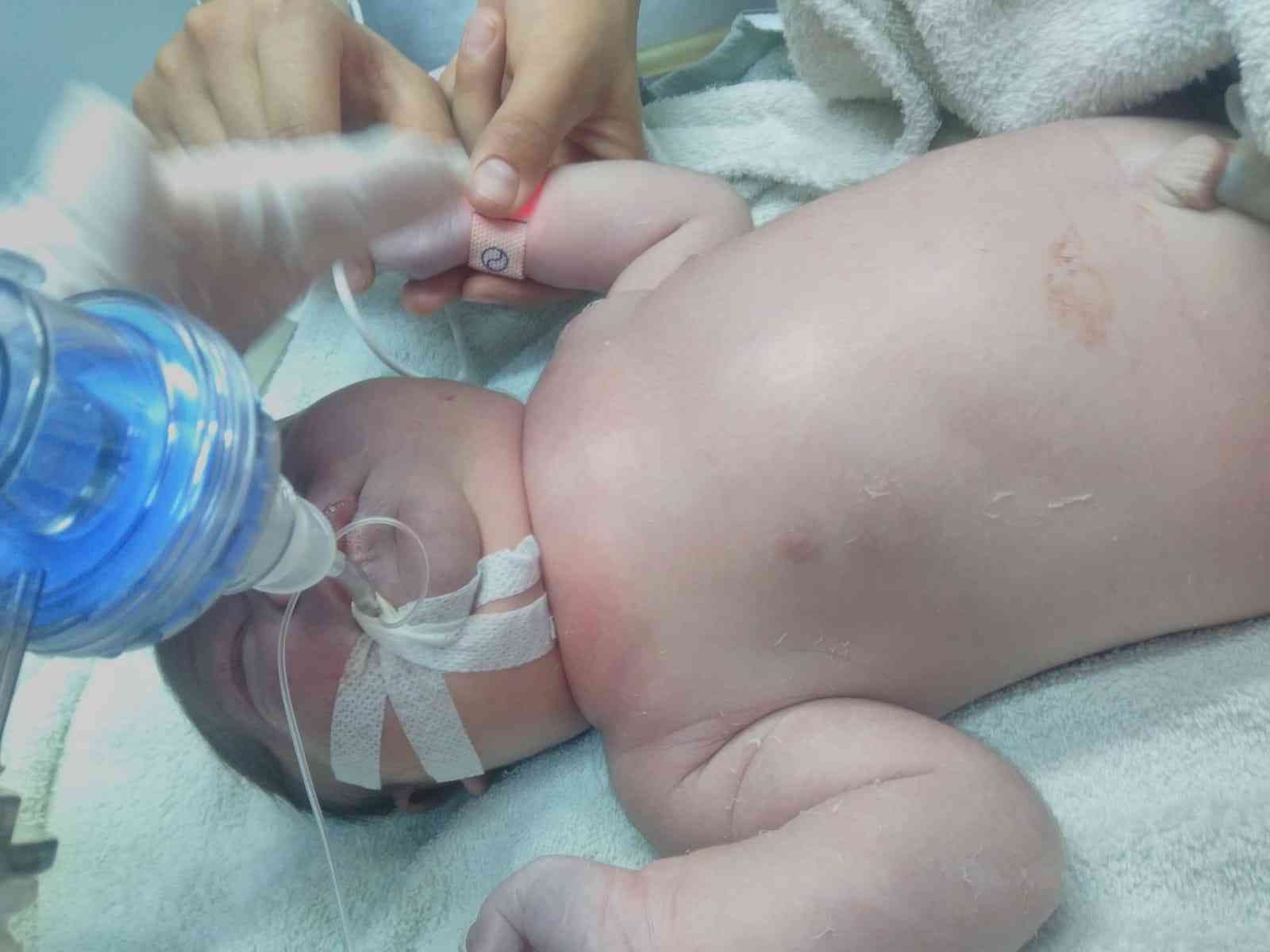 Çanakkale’nin Gökçeada ilçesinde doğuma giren bir doktorun bebeğin köprücük kemiğini kırdığı ve vücudunda morluklar oluştuğu iddia edildi ...