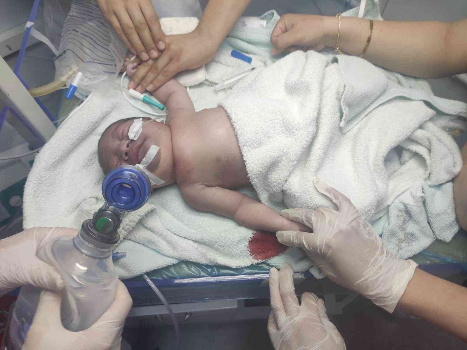 Çanakkale’nin Gökçeada ilçesinde doğuma giren bir doktorun bebeğin köprücük kemiğini kırdığı ve vücudunda morluklar oluştuğu iddia edildi ...