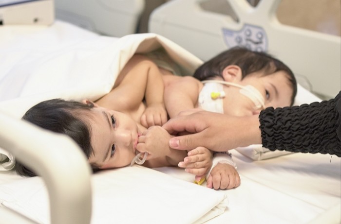 Cezayirli siyam ikizi bebekler, İstanbul’da gerçekleştirilen operasyonla ayrıldı. Ayrı kalplere sahip olup göğüs kemiğinden birbirine yapışık ...