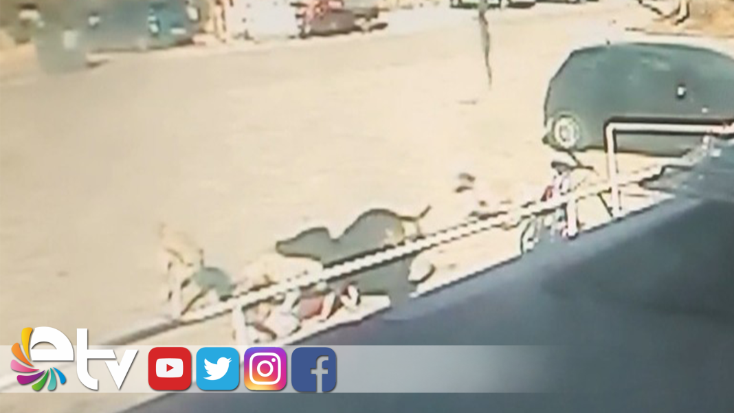 EDİRNE’DE-SAHİPSİZ-KÖPEKLER-ÇOCUĞA-SALDIRDI