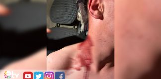 Köyde Düğün Sonrası Bıçaklı Kavga İddiası